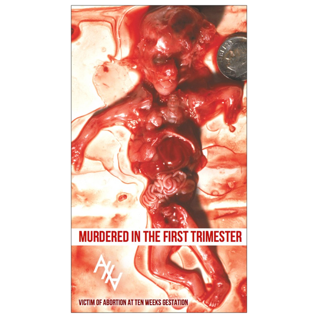 "Murdered in the First Trimester" Dropcard