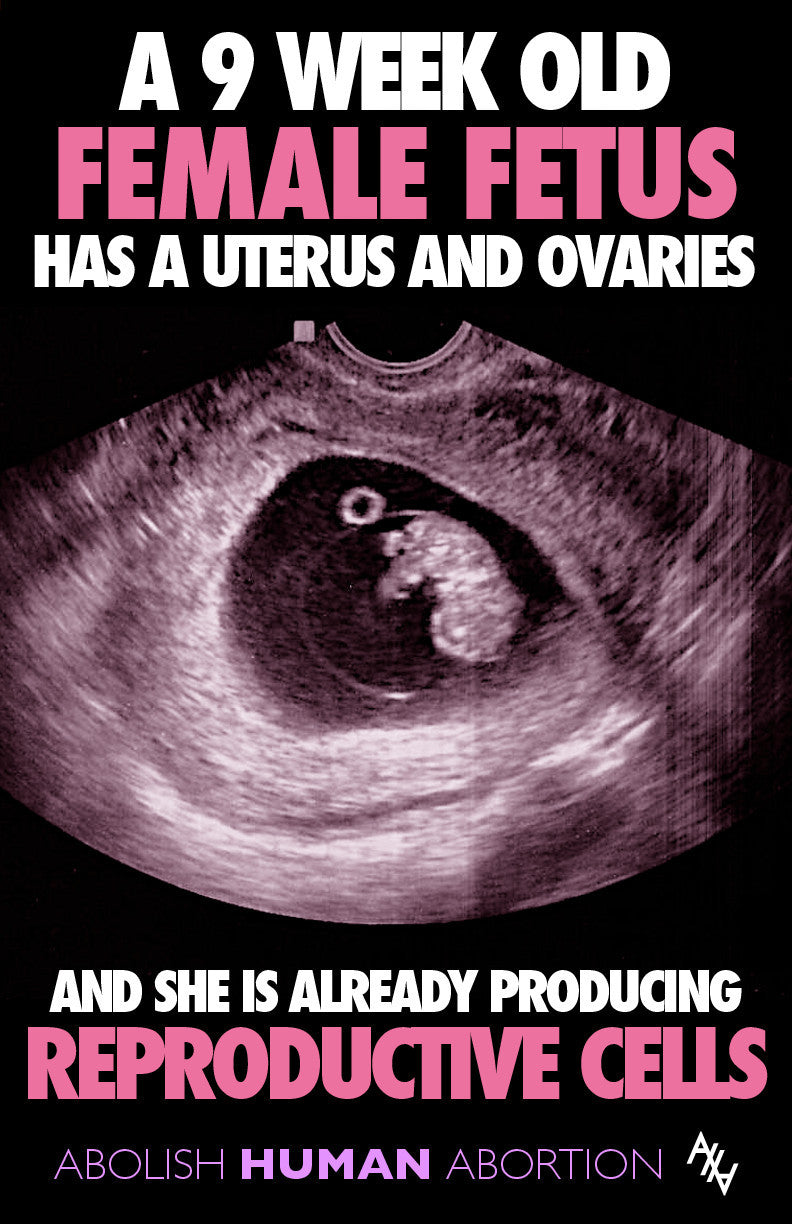 A Female Fetus has a Uterus Sign