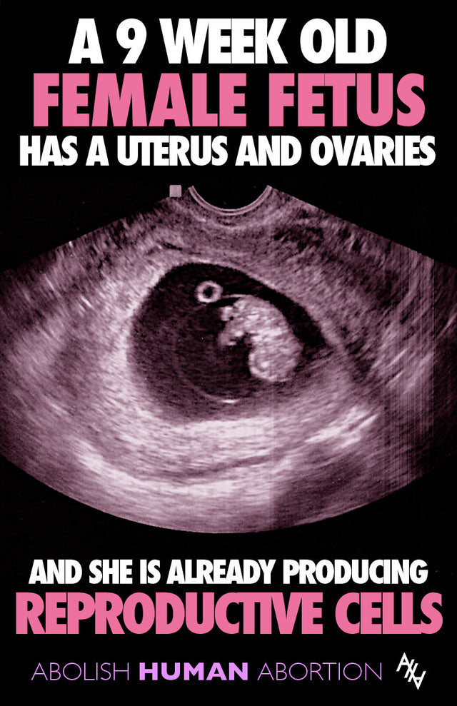 A Female Fetus has a Uterus Sign